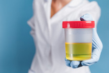 urine